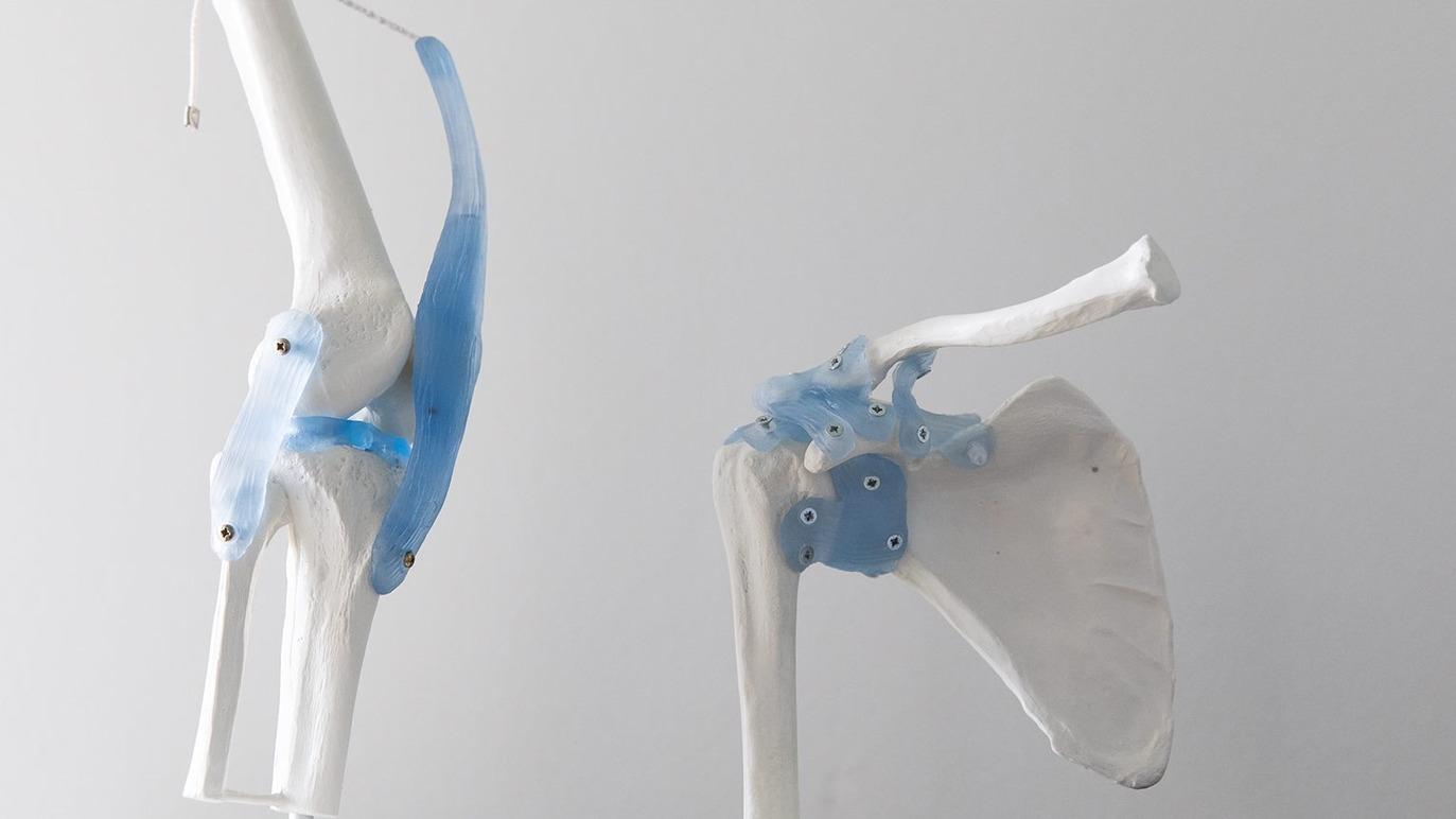 To anatomiske modeller af skulderled, der viser knogler og ledstrukturer i detaljer.