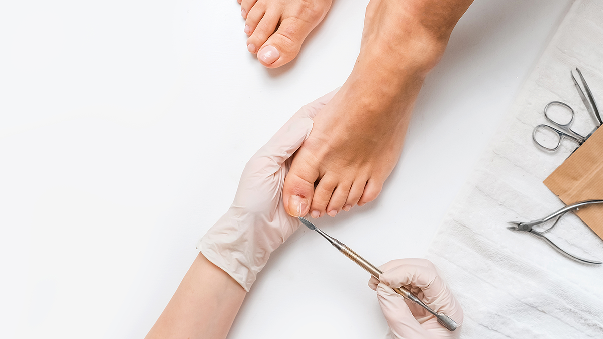 En fodbehandling med en person, der får pedicure, mens en behandler bruger værktøjer til neglepleje.
